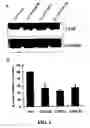 Fig. 03 - Methods and compositions for diagnosing and suppressing metastasis thereof