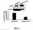 Fig. 04 - Methods and compositions for diagnosing and suppressing metastasis thereof