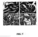 Fig. 08 - Methods and compositions for diagnosing and suppressing metastasis thereof