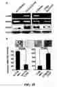 Fig. 11 - Methods and compositions for diagnosing and suppressing metastasis thereof