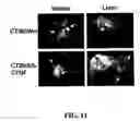Fig. 12 - Methods and compositions for diagnosing and suppressing metastasis thereof