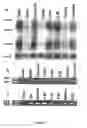 Fig. 05 - WDR36 Gene Alterations and Glaucoma