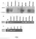 Fig. 06 - WDR36 Gene Alterations and Glaucoma