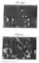 Fig. 03 - Lineage specific cells and progenitor cells
