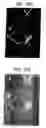 Fig. 13 - Lineage specific cells and progenitor cells