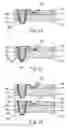 Fig. 07 - Three-dimensional package and method of making the same