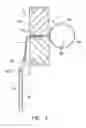 Fig. 04 - Portable exercise apparatus