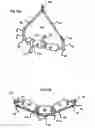 Fig. 02 - Abdominal exercise bar accessory and method use