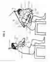 Fig. 07 - Abdominal exercise bar accessory and method use