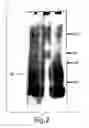 Fig. 03 - Methods for treating interleukin-18 mediated disorders with interleukin-18 binding proteins