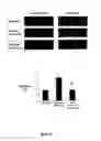 Fig. 06 - Method of reducing the effects of ischemia by administration of a thrombopoietin receptor ligand