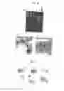 Fig. 11 - Novel endonuclease of immune cell, process for producing the same and immune adjuvant using the same