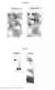 Fig. 20 - Novel endonuclease of immune cell, process for producing the same and immune adjuvant using the same