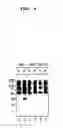 Fig. 12 - Beta secretase polypeptides