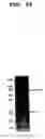 Fig. 14 - Beta secretase polypeptides