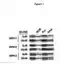 Fig. 14 - Activation of hypoxia-inducible gene expression
