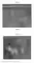 Fig. 19 - Poly(ureaurethane)s, articles and coatings prepared therefrom and methods of making the same