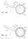 Fig. 05 - Apparatus and method for performing therapeutic tissue ablation and brachytherapy