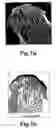 Fig. 05 - Electromagnetic field stimulator device for anatomic biophysical chondroprotection