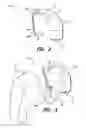 Fig. 03 - In the ear auxiliary microphone system for behind the ear hearing prosthetic
