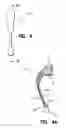 Fig. 04 - In the ear auxiliary microphone system for behind the ear hearing prosthetic