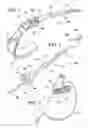 Fig. 02 - Method of implating a medical device using a suture tab extender