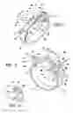 Fig. 03 - Method of implating a medical device using a suture tab extender