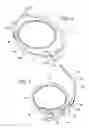 Fig. 04 - Method of implating a medical device using a suture tab extender