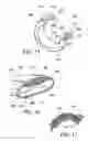 Fig. 07 - Method of implating a medical device using a suture tab extender