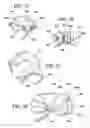 Fig. 10 - Method of implating a medical device using a suture tab extender