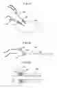 Fig. 16 - Object observation system and method utilizing three dimensional imagery and real time imagery during a procedure