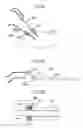 Fig. 27 - Object observation system and method utilizing three dimensional imagery and real time imagery during a procedure