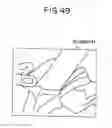 Fig. 38 - Object observation system and method utilizing three dimensional imagery and real time imagery during a procedure