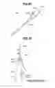 Fig. 65 - Object observation system and method utilizing three dimensional imagery and real time imagery during a procedure