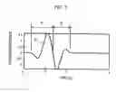 Fig. 04 - Ultrasonic enhanced-contrast imager and method