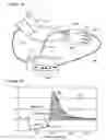 Fig. 12 - Method and apparatus for isolating the vascular component in digital temerature monitoring