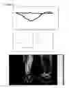 Fig. 15 - Method and apparatus for isolating the vascular component in digital temerature monitoring