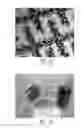 Fig. 11 - Breath and breath condensate analysis system and associated methods