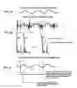 Fig. 04 - Method and system for removing noise by using change in activity pattern