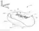 Fig. 01 - UNIVERSAL CATHETER ANCHORING SYSTEM