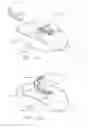 Fig. 11 - UNIVERSAL CATHETER ANCHORING SYSTEM