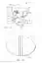 Fig. 17 - UNIVERSAL CATHETER ANCHORING SYSTEM