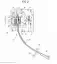 Fig. 03 - CATHETER ANCHORING SYSTEM