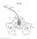 Fig. 05 - CATHETER ANCHORING SYSTEM