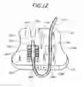 Fig. 10 - CATHETER ANCHORING SYSTEM