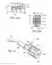 Fig. 11 - CATHETER ANCHORING SYSTEM