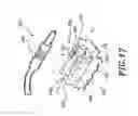 Fig. 14 - CATHETER ANCHORING SYSTEM