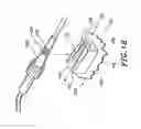 Fig. 15 - CATHETER ANCHORING SYSTEM