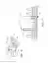 Fig. 07 - Securement device for indwelling catheters or introducers