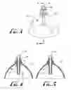 Fig. 03 - Wound irrigation splashback shield